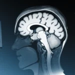 Brain scan with faint face outline and family photo showing melancholic blue tones