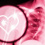 Mammogram screen showing white calcium sparks with pink backdrop and faint heart outline.